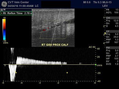 Ultrasound assessment